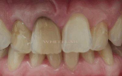 Un sorriso complesso: l’importanza di offrire soluzioni alternative